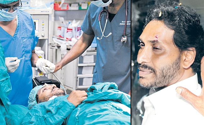 YSRCP, MN wing condemns the Attack on CM Jagan